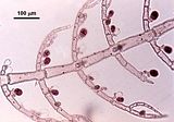 5 - Tetrasporofito con tetrasporocisti